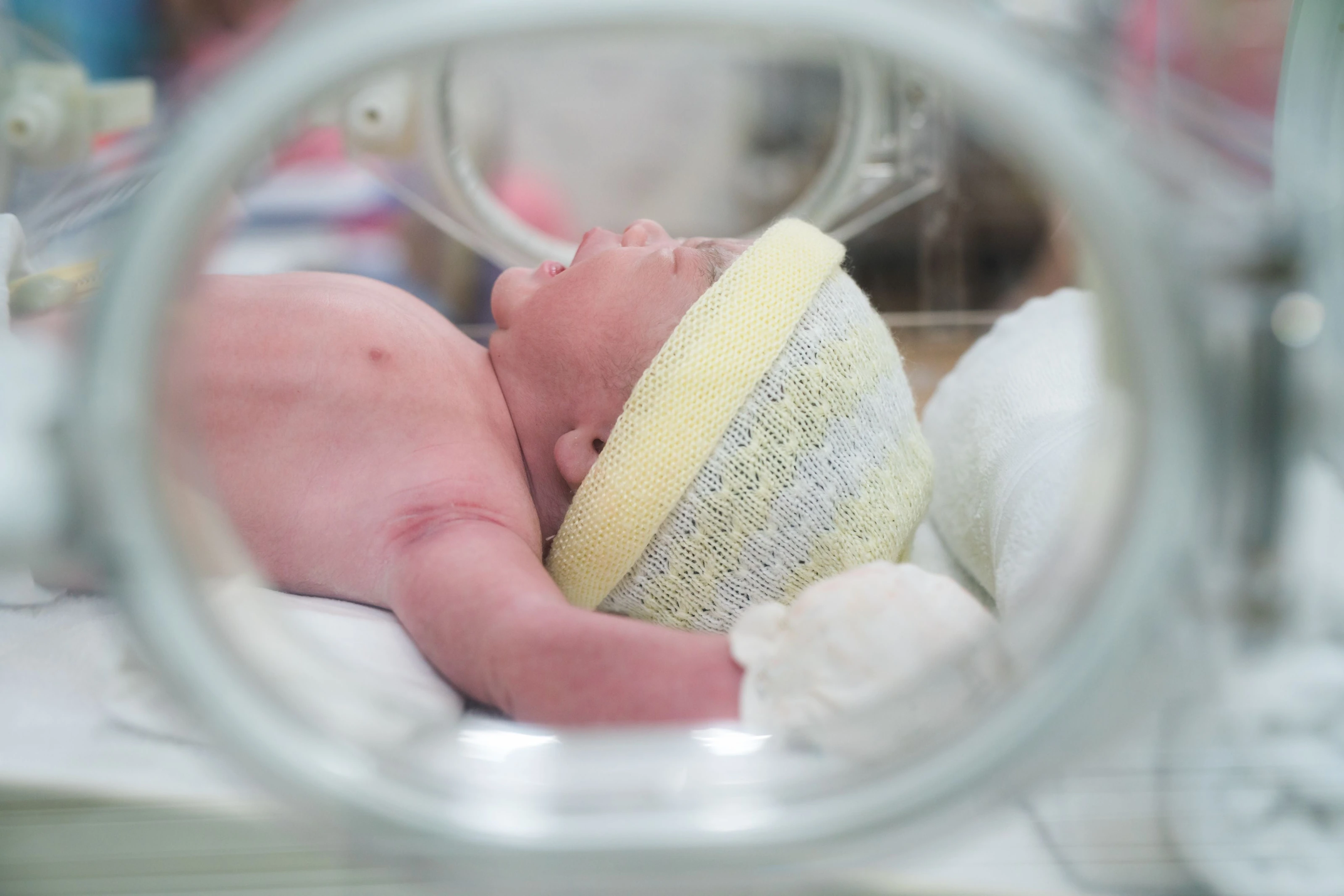 A premature infant receiving care in a neonatal incubator